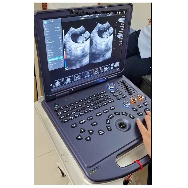 Veterinary Ultrasound Scanner Portable - Dawei Portable Ultrasound Veterinary Dog Ultrasound