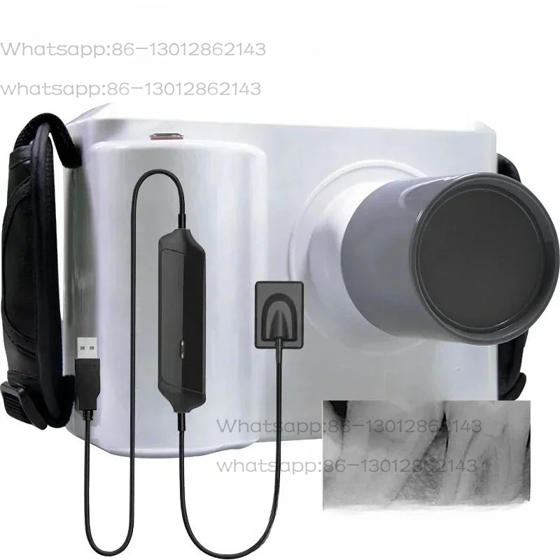 Full Set Portable Dental X ray - Veterinary X Ray Machine review and price