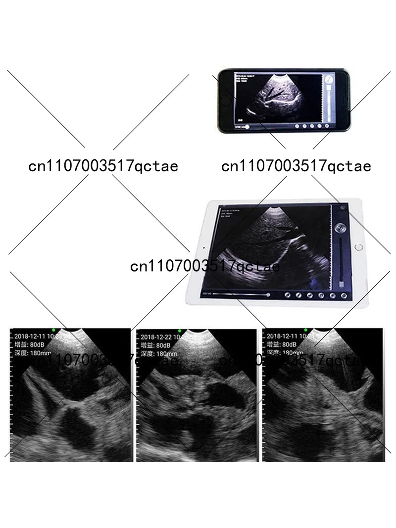64 Element Wireless Veterinary - Livestock Ultrasound Pregnancy review and price