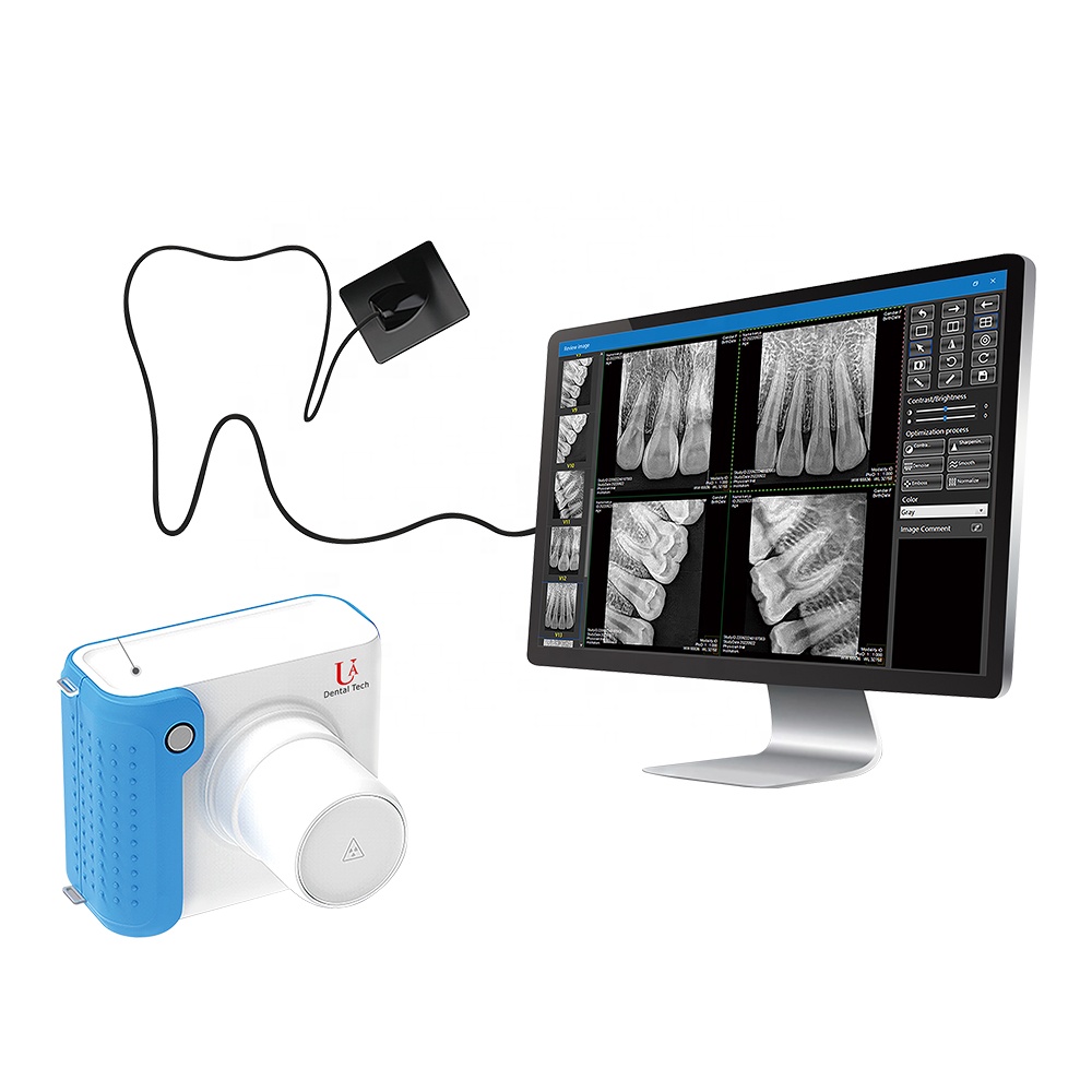 Photon-Counting Dental-Veterin - Veterinary X Ray Machine review and price