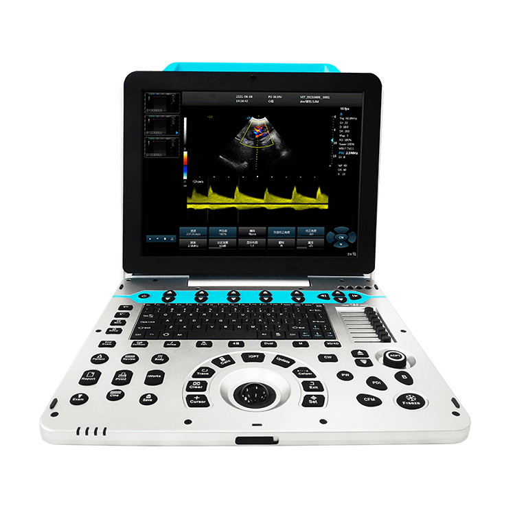 VUP5 Portable Vet Scanner 4D V - Veterinary Ultrasound Scanner Portable review and price