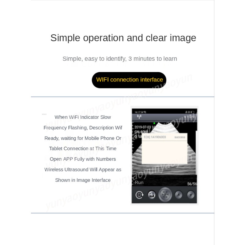 Wireless Mechanical Veterinary - Livestock Ultrasound Pregnancy review and price