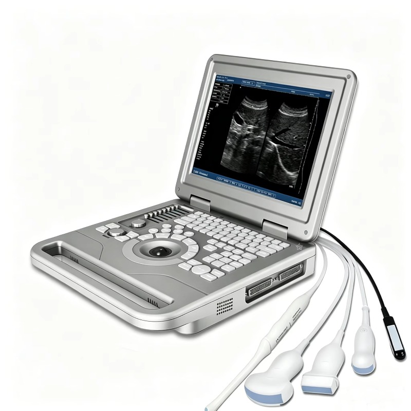 Portable Veterinary Ultrasound - Veterinary Ultrasound Scanner Portable review and price