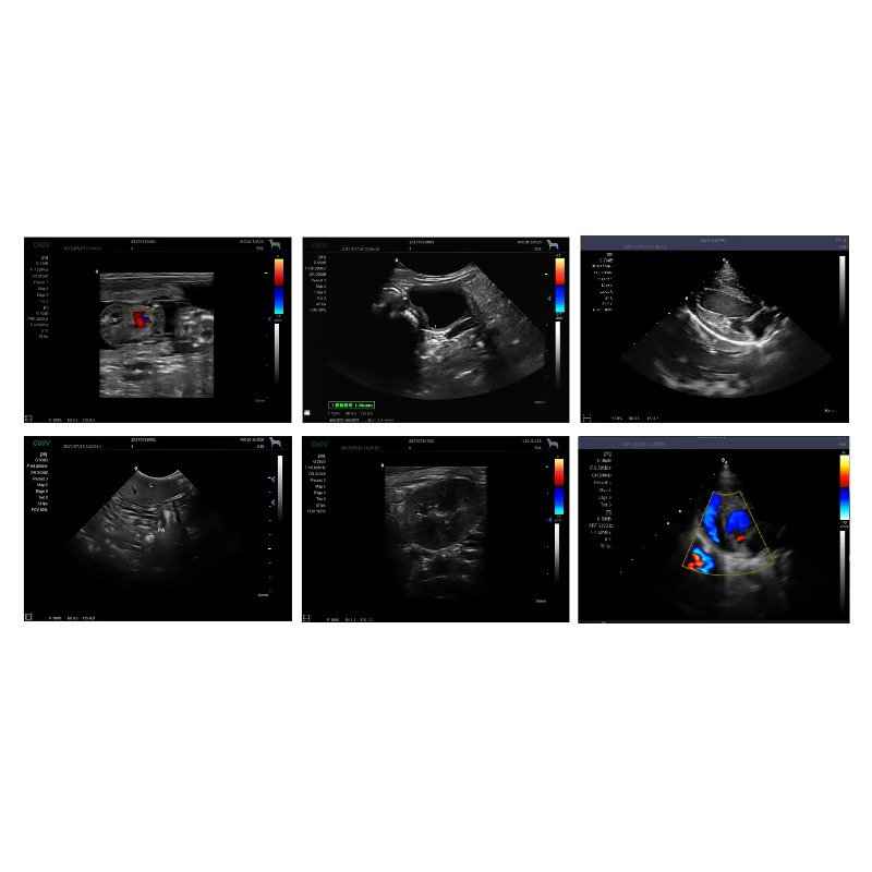 Portable Veterinary Ultrasound - Veterinary Ultrasound Scanner Portable review and price