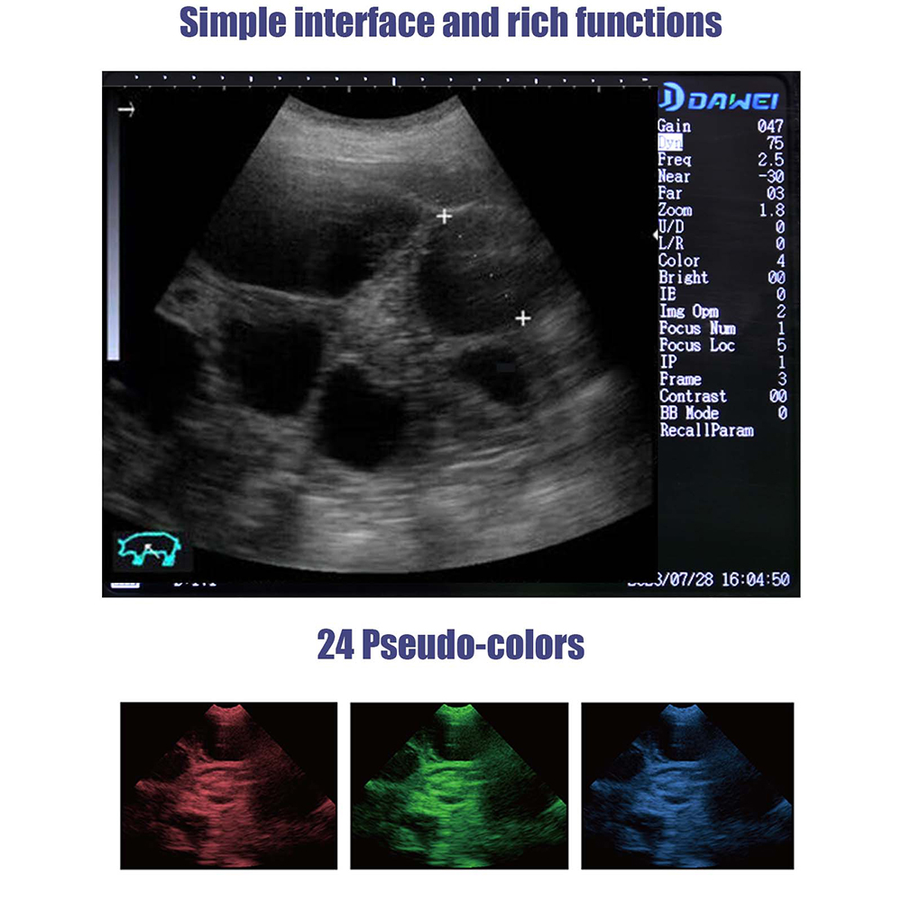 Portable Veterinary Ultrasound - Veterinary Ultrasound Scanner Portable review and price