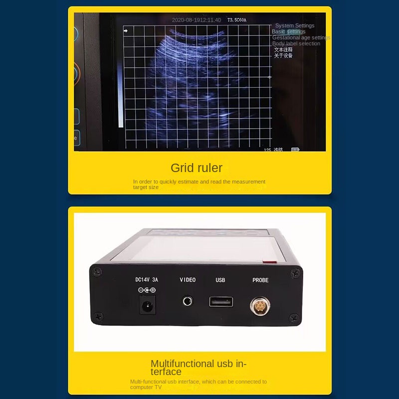 5.6 Inch Portable Veterinary U - Livestock Ultrasound Pregnancy review and price