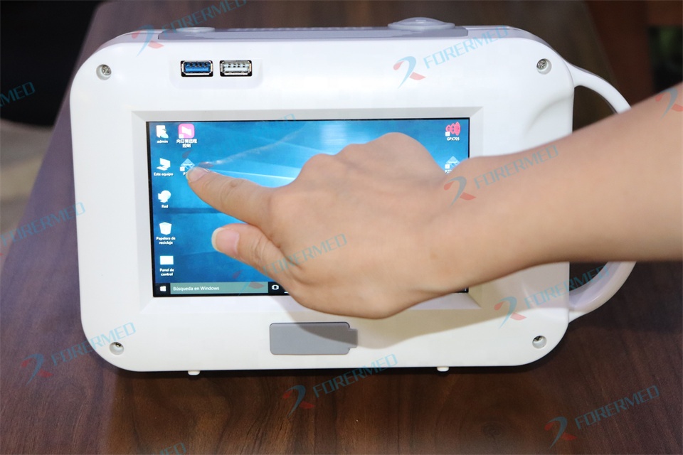 Mini Veterinary X Ray Machine  - Veterinary X Ray Machine review and price
