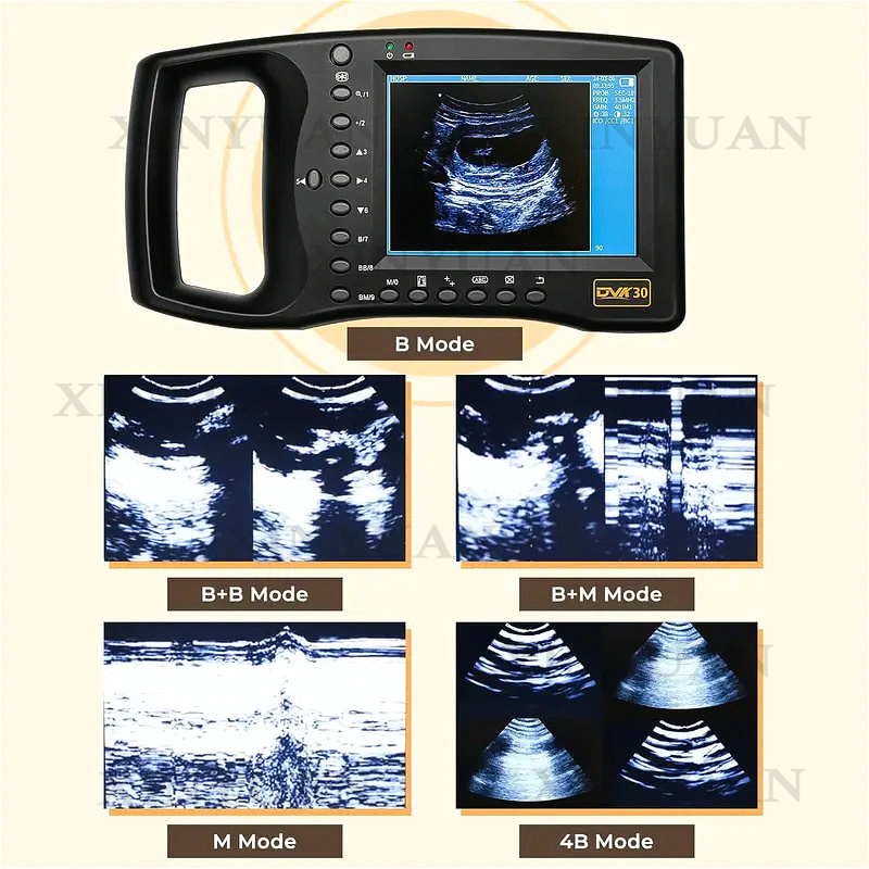 Ultrasound Machine Pregnancy P - Livestock Ultrasound Pregnancy review and price